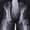 X-Ray